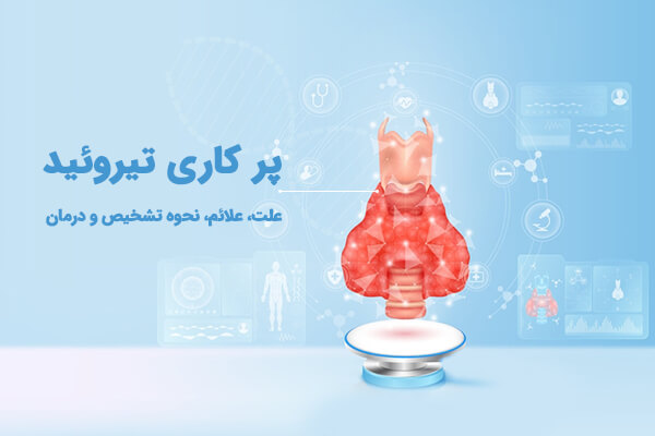 پرکاری تیروئید چیست؟ علائم، نحوه تشخیص و درمان تیروئید پرکار