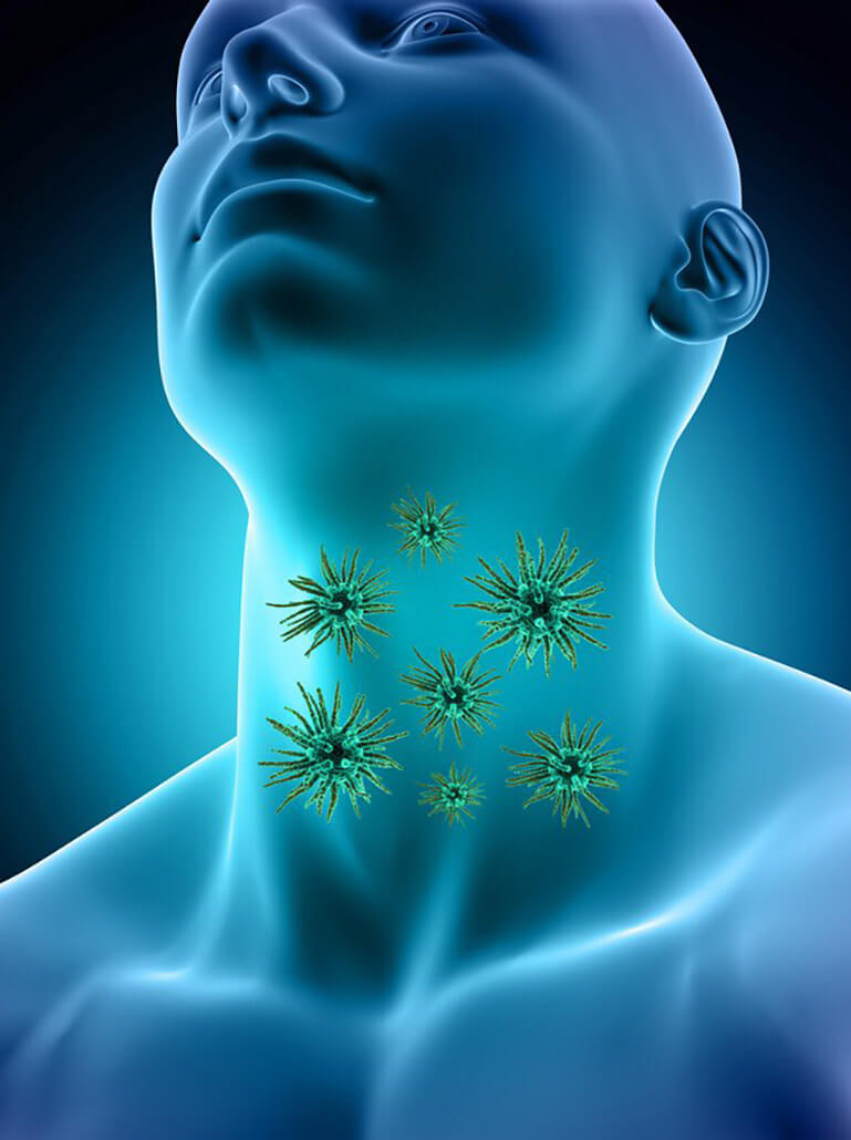 male-medical-figure-with-sore-throat-virus-cells_1048-7650 Male medical figure with sore throat virus cells 1048 7650