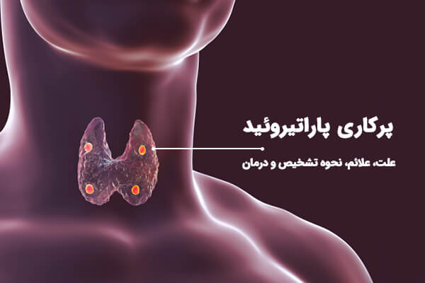 Hyperparathyroidism