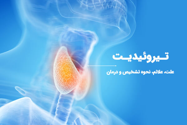 Thyroiditis