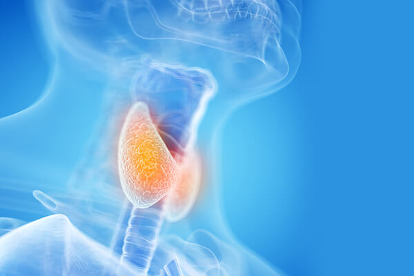 Thyroiditis en
