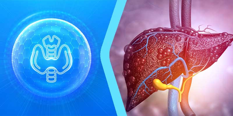 ارتباط کم کاری تیروئید و کبد چرب