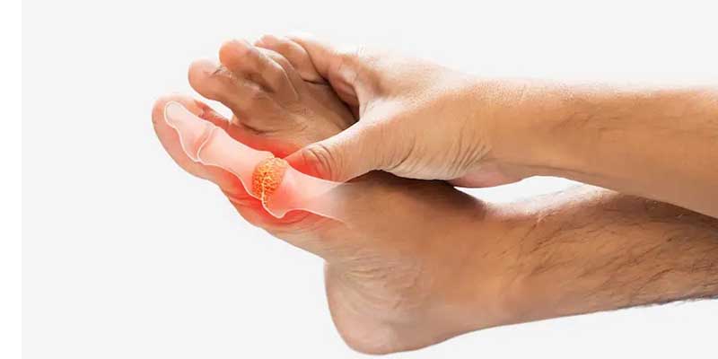 نقرس و کم کاری تیروئید از تشخیص تا درمان