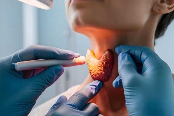 thyroid-goiter-embolization-treatment آمبولیزاسیون تیروئید برای درمان گواتر