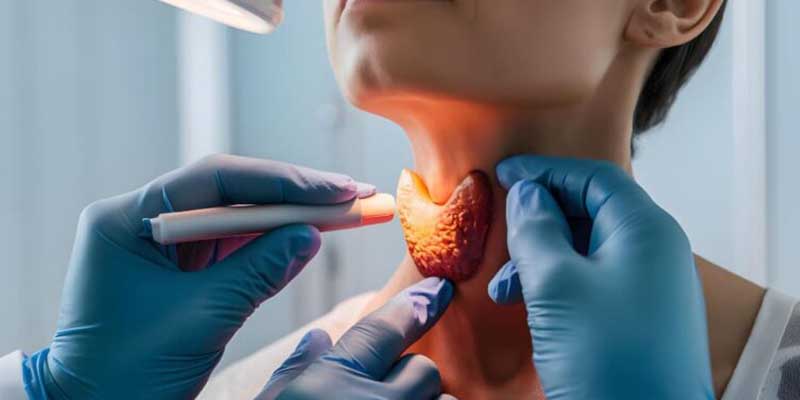 آمبولیزاسیون تیروئید برای درمان گواتر