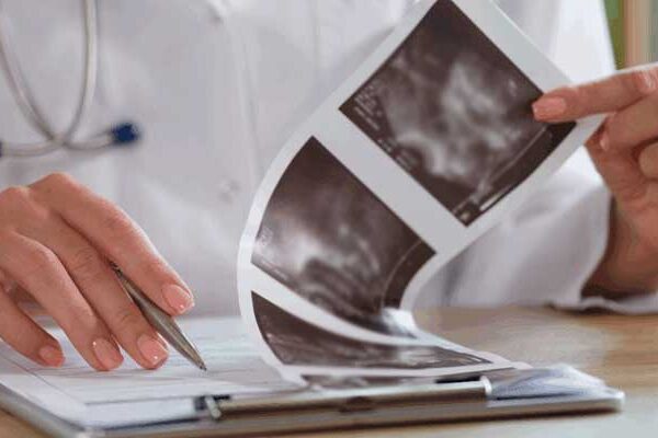 thyroid-ultrasound-report تفسیر سونوگرافی تیروئید
